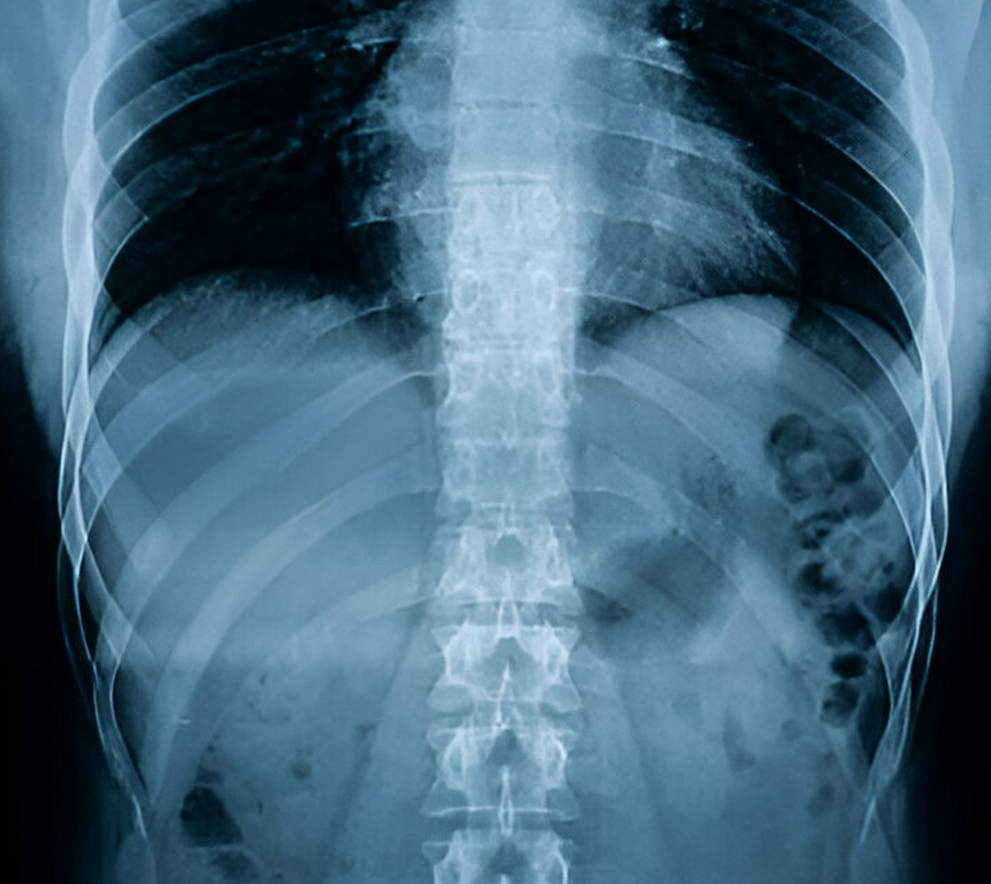 Family Clinic in Johor Bahru Medical Check Up in Johor Bahru X ray